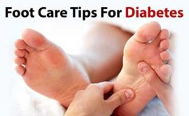 نحوه مراقبت پا در دیابت | دکتر محمد رسول شرانجانی