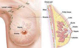 عمل سرطان سینه