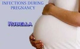سرخجه در بارداری